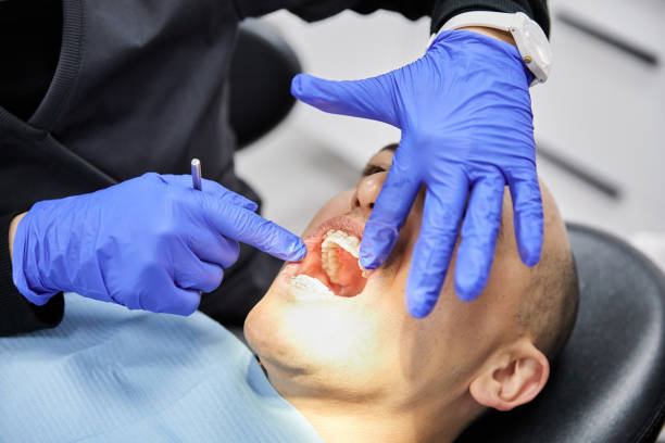 Best Emergency Tooth Extraction in Oak Ridge North, TX