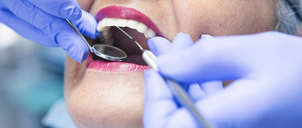 Best Emergency Wisdom Teeth Removal in Oak Ridge North, TX